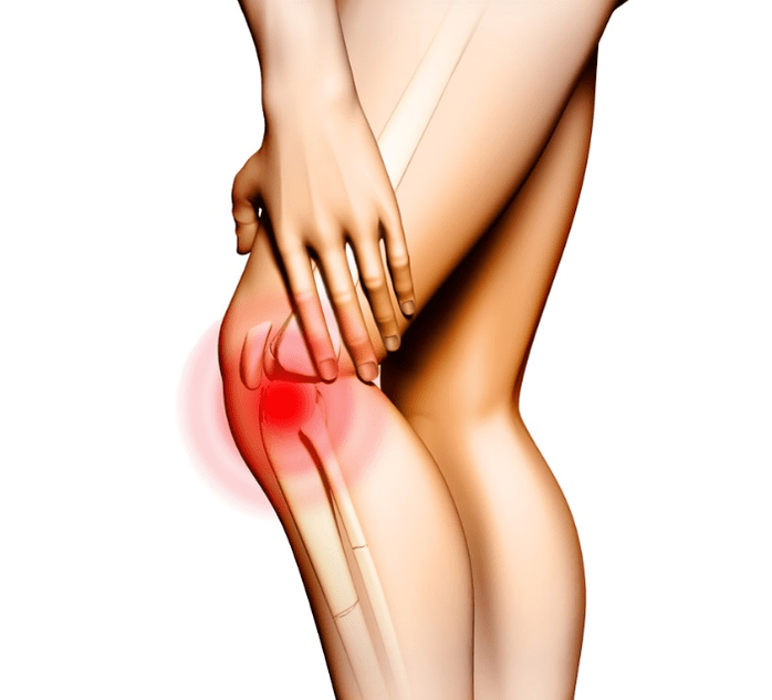 Stages of arthrosis