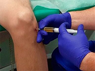 injection in the knee joint